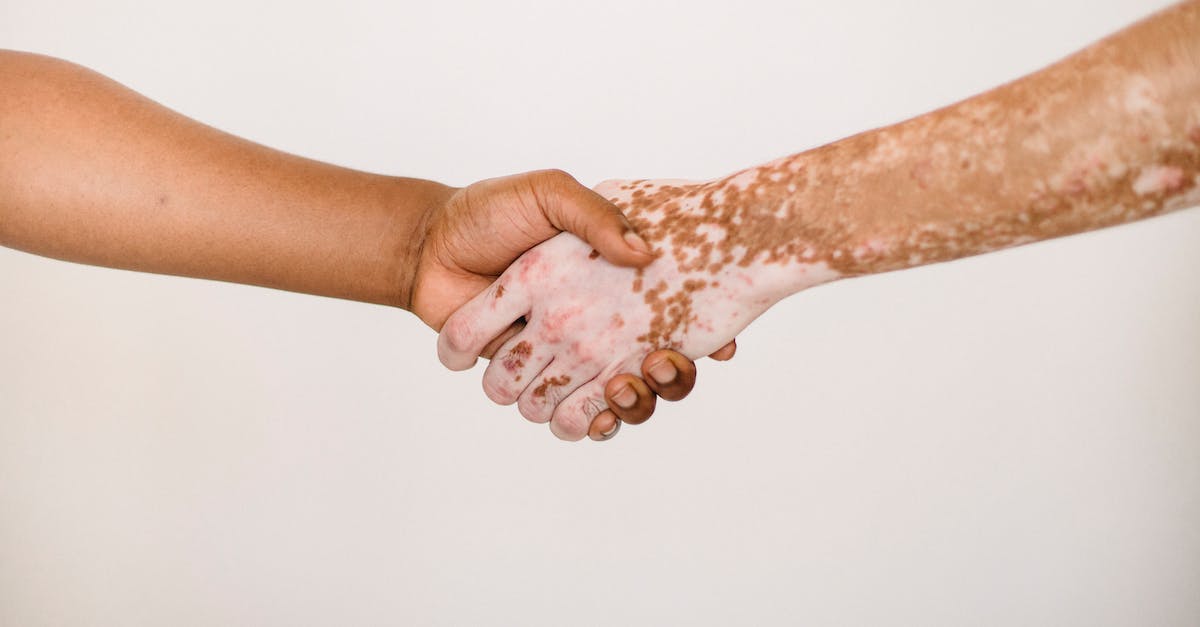 Can everyone join the Tribunal? - Crop anonymous man shaking hand of male friend with vitiligo skin against white background Can everyone join the Tribunal? - Crop anonymous man shaking hand of male friend with vitiligo skin against white background