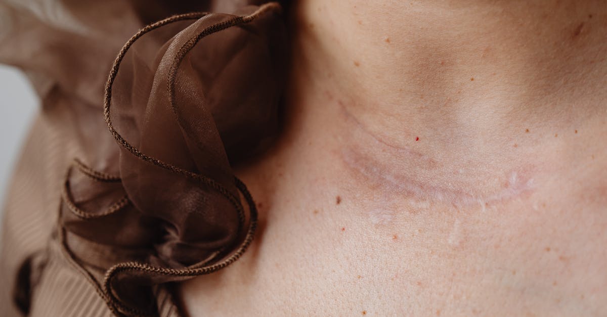 Do skin makers with lower-rarity skins get more money? - Close up of a Scar on a Neck