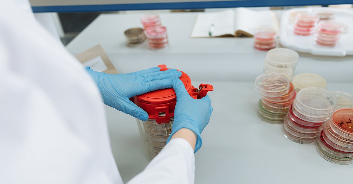 Does Dueling in Brotherhood of Blood affect K/D spread? - Free stock photo of biochemistry, biology, blood