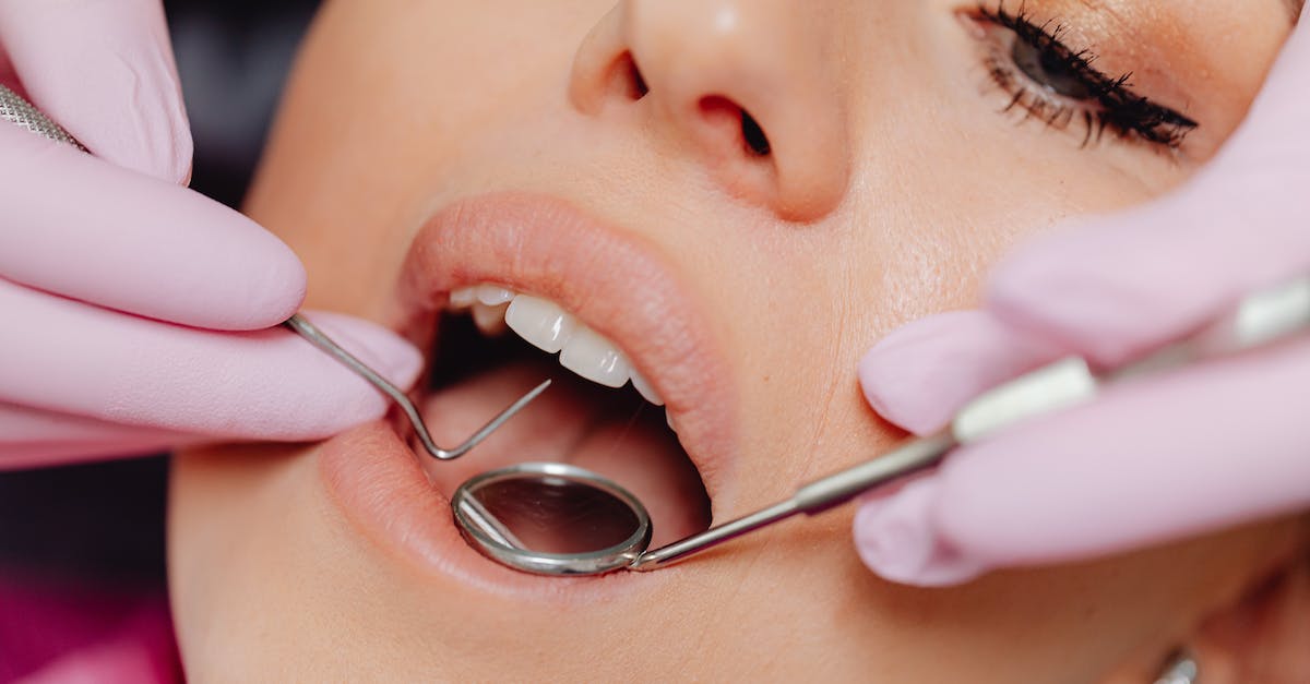 Dwarves Are Not Cleaning Up Corpses and Vomit - Close-Up Photo of a Woman Getting a Dental Check-Up Dwarves Are Not Cleaning Up Corpses and Vomit - Close-Up Photo of a Woman Getting a Dental Check-Up