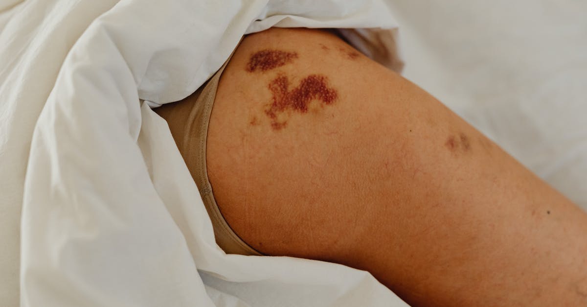 Enemy Tick marks on compass - Free stock photo of bed, blood, cure Enemy Tick marks on compass - Free stock photo of bed, blood, cure