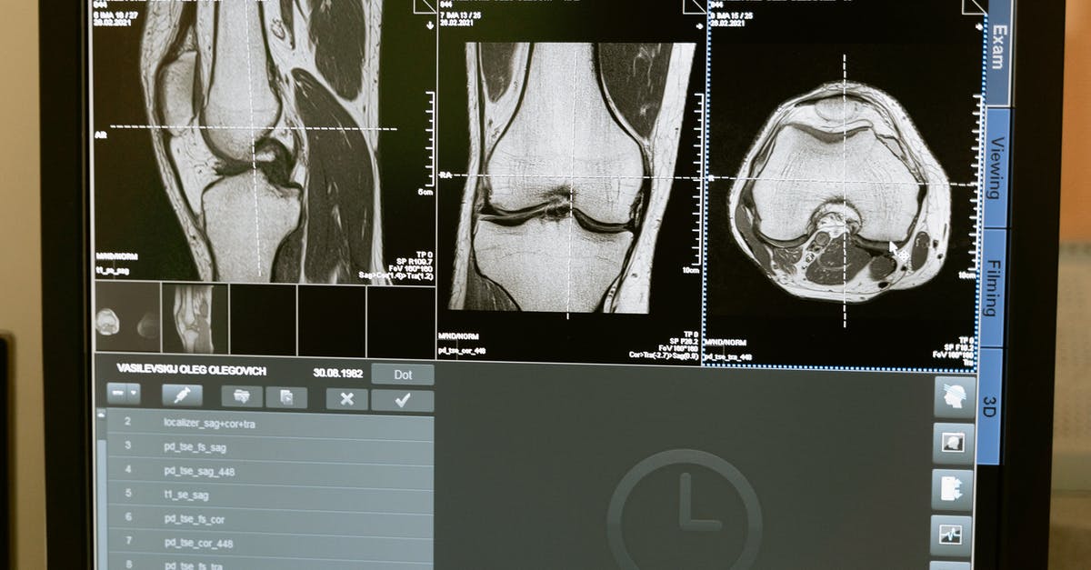 How can I test for a player at a given x and z but at any height? - Free stock photo of analysis, anatomy, bone How can I test for a player at a given x and z but at any height? - Free stock photo of analysis, anatomy, bone