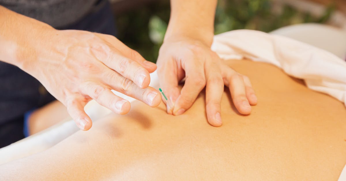 How to escape from the Stronghold of the Master Assassin? - From above of crop anonymous man applying needles on back of client during acupuncture procedure