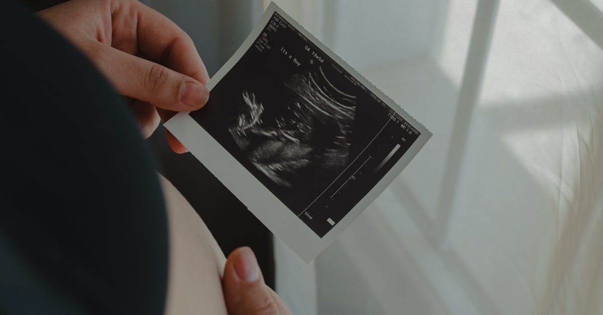 How to test if a passive mob is a baby with command blocks? - Person Holding an Ultrasound Scan Photo How to test if a passive mob is a baby with command blocks? - Person Holding an Ultrasound Scan Photo