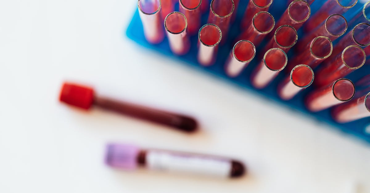 How to test which which objective is greatest? - Top view of glass covered tubes arranged on table near plastic stand with tubes placed on row in modern laboratory
