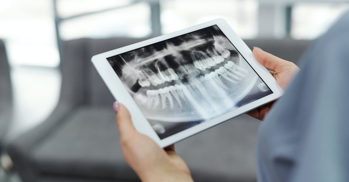 Is the Basilisk Jaw a Slayer only drop? - A Tablet with a Dental X-ray