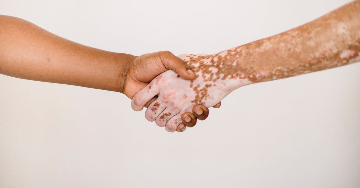 Is there any advantage to joining one team over another? - Crop anonymous man shaking hand of male friend with vitiligo skin against white background