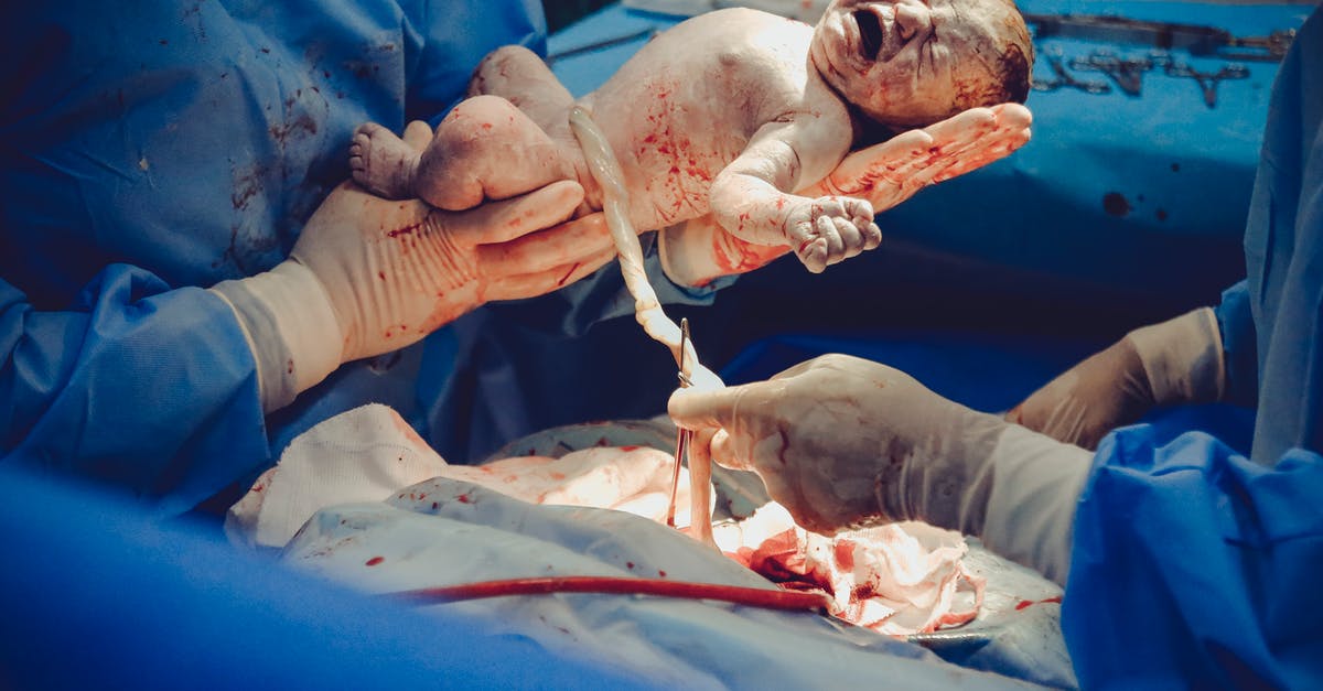 Once Operation Bloodhound ends will I still be able to level the Operation Coin? - New Born Baby