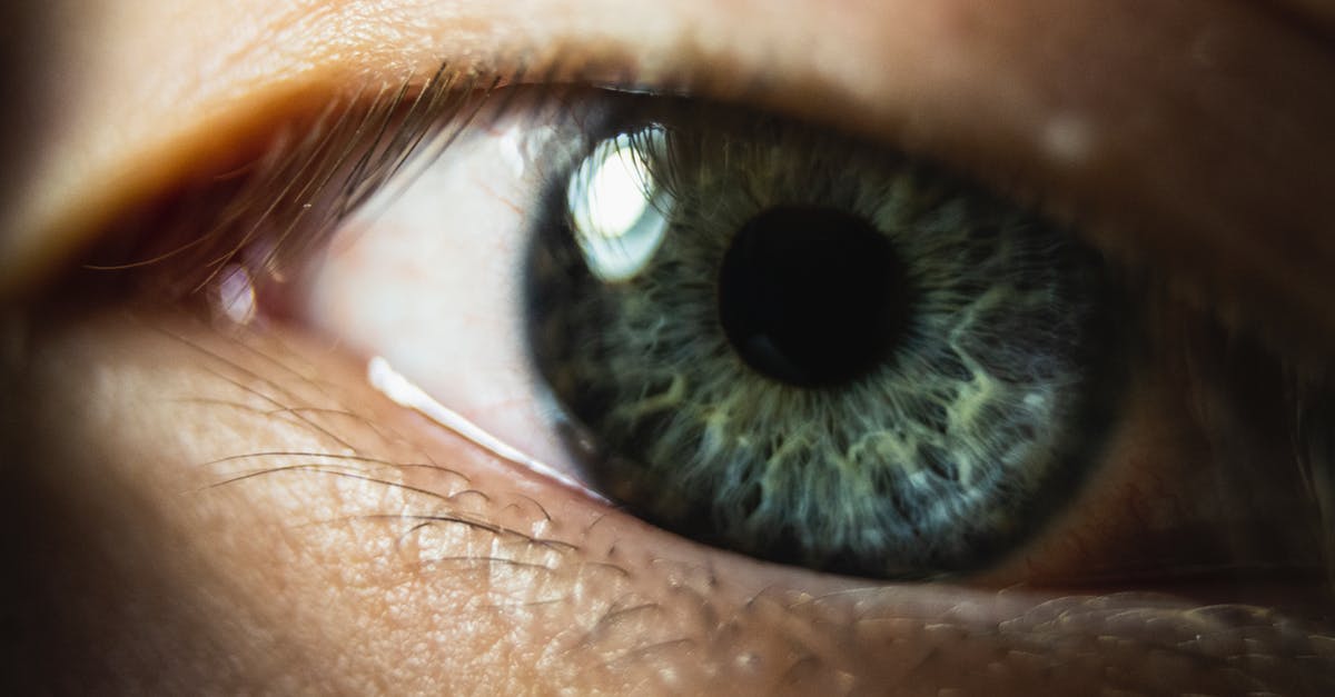 What is the eyeball icon over the troops in Rome 2 Total War? - Close Up Photo of An Eye Green and White Eye What is the eyeball icon over the troops in Rome 2 Total War? - Close Up Photo of An Eye Green and White Eye