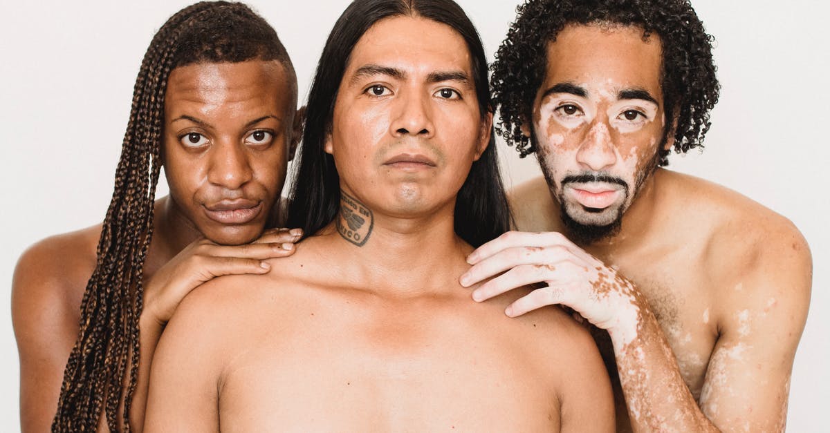 What the x means besides the gender icon? - Young black man with vitiligo skin condition standing close to partner with Afro braids and serious ethnic friend while looking at camera What the x means besides the gender icon? - Young black man with vitiligo skin condition standing close to partner with Afro braids and serious ethnic friend while looking at camera
