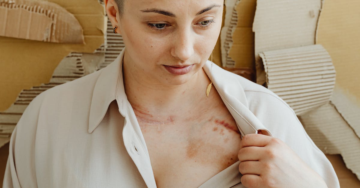 When does your health get automatically refilled? - A Woman Showing a Scar When does your health get automatically refilled? - A Woman Showing a Scar