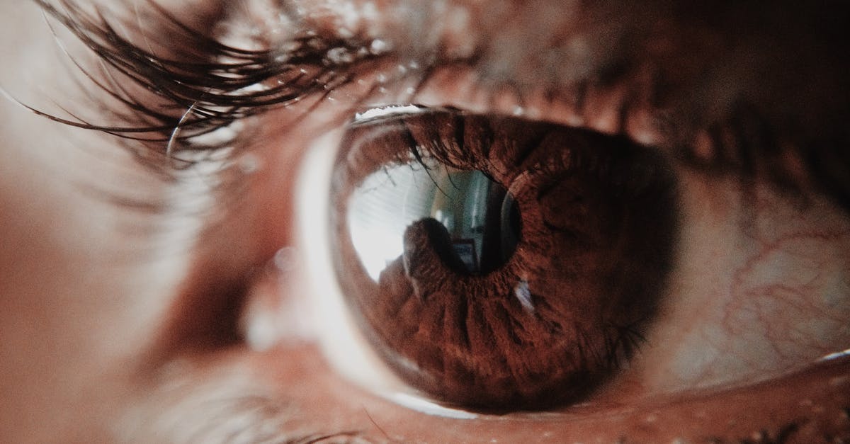 Why can't I see or interact with any heroes? [closed] - Brown Human Eye