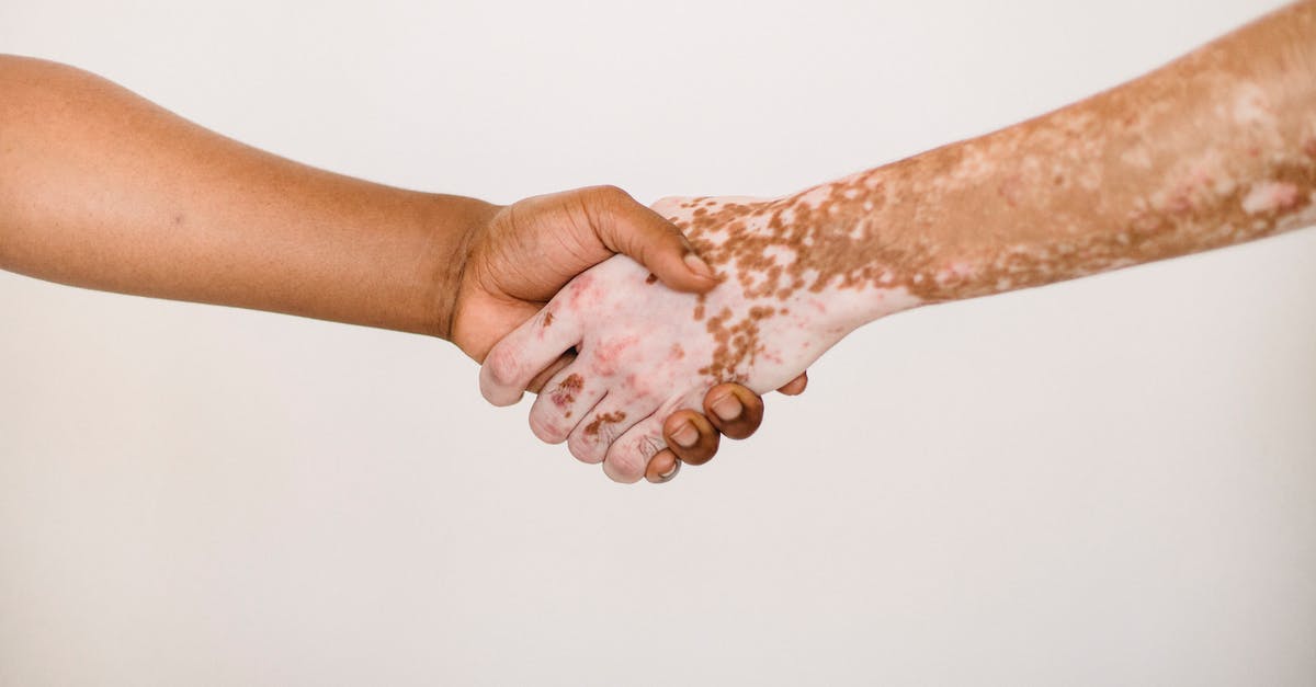Why can't I summon my friend to help me? - Crop anonymous man shaking hand of male friend with vitiligo skin against white background